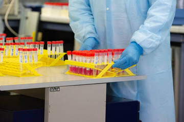 Coronavirus: i dati di mercoledì 23 dicembre