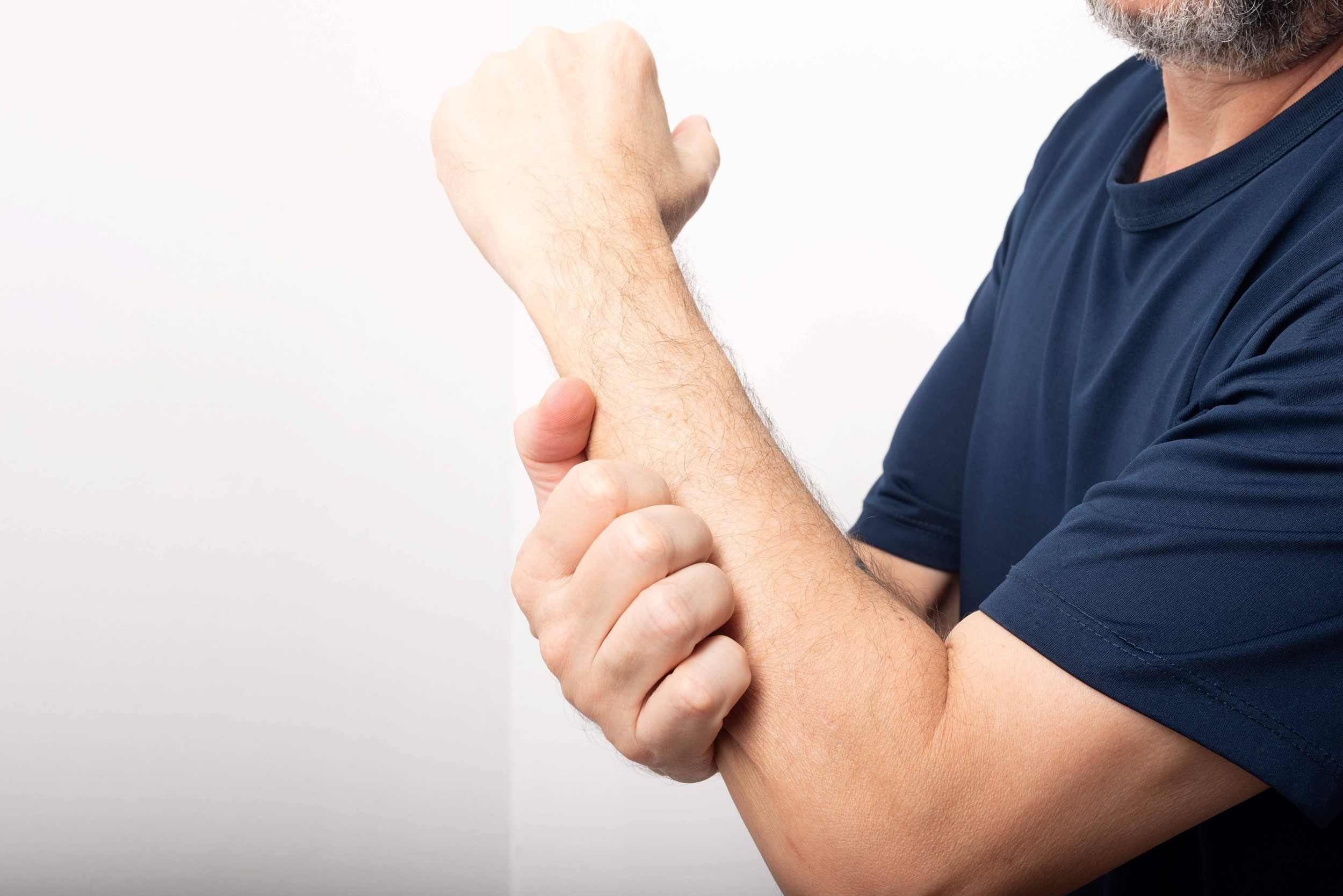 Immagine: Herpes Zoster