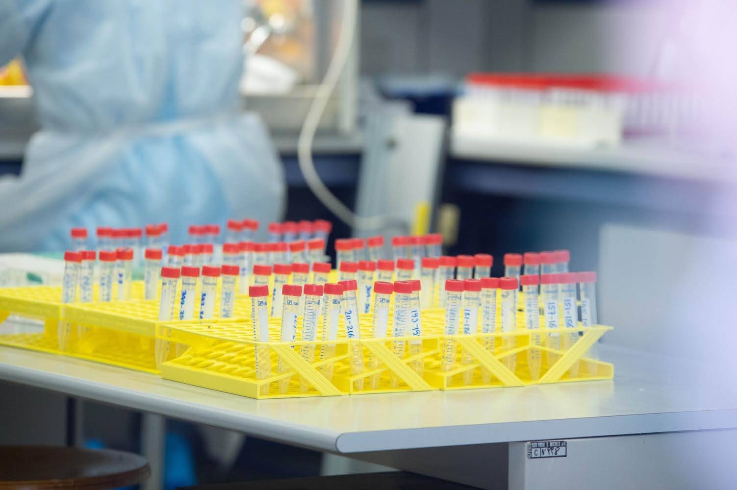 Immagine: Laboratorio tamponi Covid