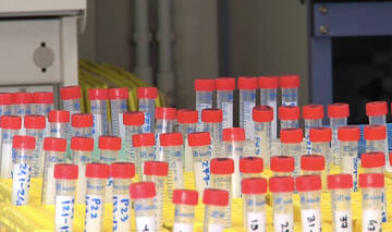 Coronavirus: 10 nuovi decessi, 153 guariti, quasi 4800 tamponi 