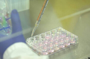 Coronavirus: i dati dal bollettino di domenica 21 febbraio 2021