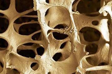 Visite gratuite per la giornata mondiale dell'osteoporosi