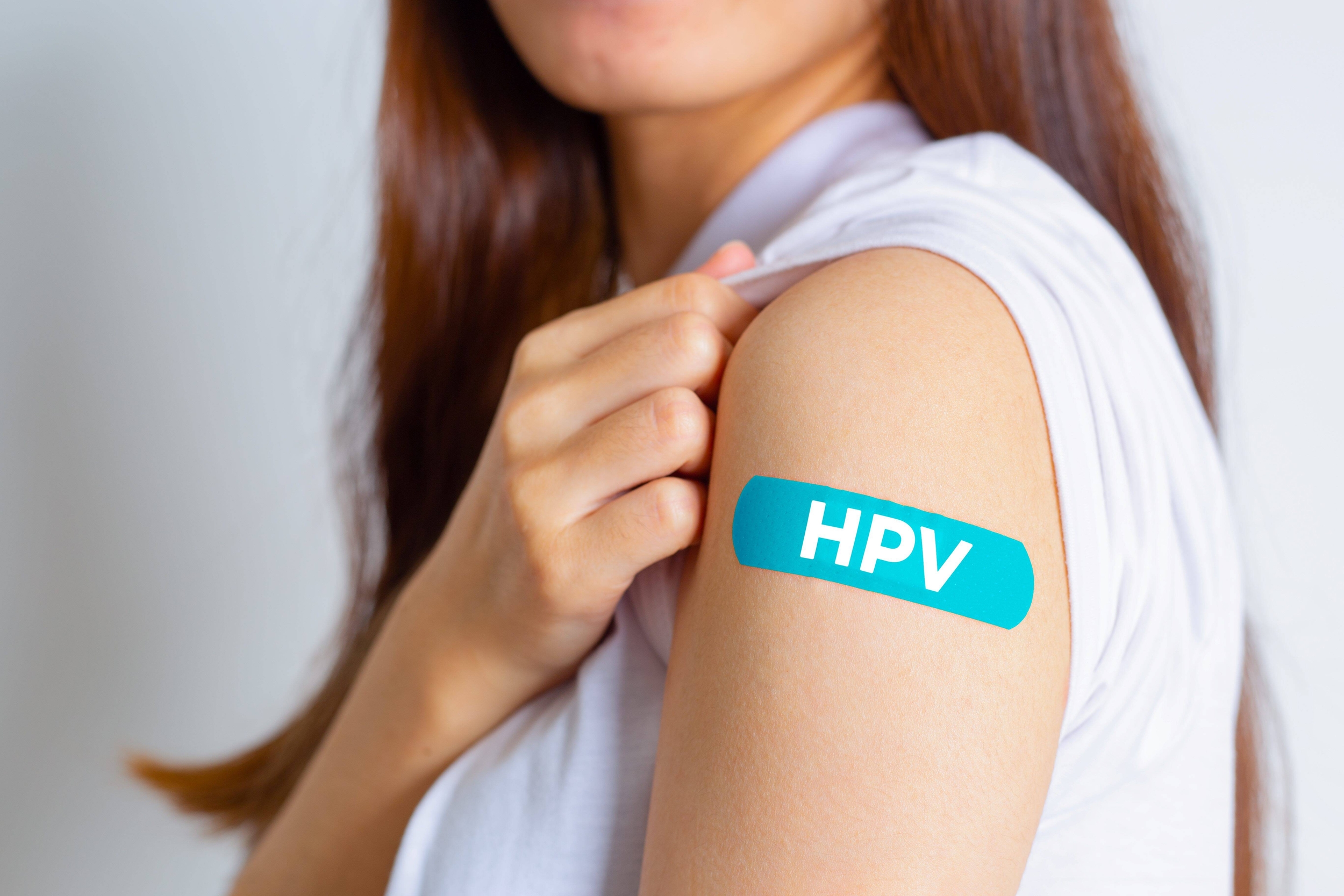 Immagine: Papilloma virus